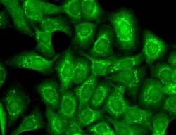 Invitrogen Slo2.2 Monoclonal Antibody (N3/26), PerCP 100 &mu;g; PerCP:Antibodies,