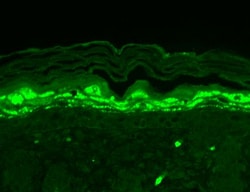 Invitrogen SHANK1 Monoclonal Antibody (N22/21), PerCP 100 &mu;g; PerCP:Antibodies,
