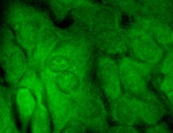 Invitrogen SHANK3 Monoclonal Antibody (S69), PerCP 100 &mu;g; PerCP:Antibodies,