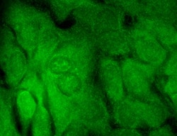 Invitrogen SHANK3 Monoclonal Antibody (S69), PE 100 &mu;g; PE:Antibodies,