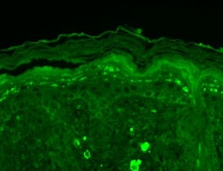 Invitrogen SHANK3 Monoclonal Antibody (S69), PE 100 &mu;g; PE:Antibodies,