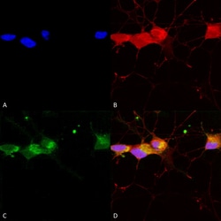 Invitrogen NMDAR2B Monoclonal Antibody (S59), FITC 100 &mu;g; FITC:Antibodies,