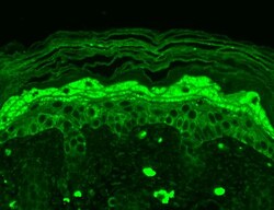 Invitrogen NMDAR2B Monoclonal Antibody (S59), FITC 100 &mu;g; FITC:Antibodies,