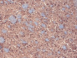 Invitrogen GABRB3 Monoclonal Antibody (N87/25), FITC 100 &mu;g; FITC:Antibodies,