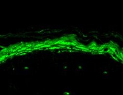 Invitrogen SCN10A Monoclonal Antibody (S134), APC 100 &mu;g; APC:Antibodies,