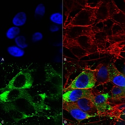 Invitrogen SCN10A Monoclonal Antibody (S134), FITC 100 &mu;g; FITC:Antibodies,