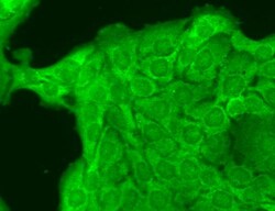 Invitrogen SCN10A Monoclonal Antibody (S134), FITC 100 &mu;g; FITC:Antibodies,