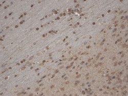 Invitrogen TRPC5 Monoclonal Antibody (N67/15), PerCP 100 &mu;g; PerCP:Antibodies,