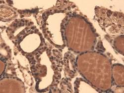 Invitrogen SLC5A5 Monoclonal Antibody (FP5), APC 100 &mu;g; APC:Antibodies,