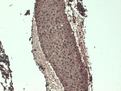 Invitrogen SLC5A5 Monoclonal Antibody (FP5), APC 100 &mu;g; APC:Antibodies,