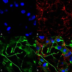Invitrogen VAChT Monoclonal Antibody (N6/38), PE 100 &mu;g; PE:Antibodies,