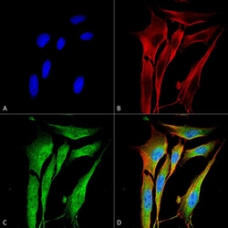 Invitrogen MMP9 Monoclonal Antibody (L51/82), FITC 100 &mu;g; FITC:Antibodies,