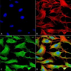 Invitrogen ATP7B Monoclonal Antibody (L62/29), FITC 100 &mu;g; FITC:Antibodies,