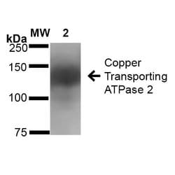 Invitrogen ATP7B Monoclonal Antibody (L62/29), FITC 100 &mu;g; FITC:Antibodies,