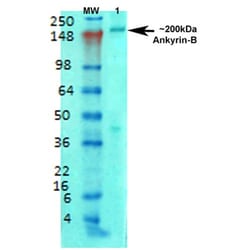 Invitrogen Ankyrin B Monoclonal Antibody (N105/13), FITC 100 &mu;g; FITC:Antibodies,