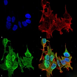 Invitrogen Ankyrin B Monoclonal Antibody (N105/13), PerCP 100 &mu;g; PerCP:Antibodies,
