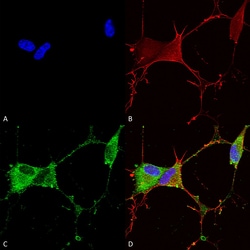 Invitrogen GABBR2 Monoclonal Antibody (N81/2), FITC 100 &mu;g; FITC:Antibodies,