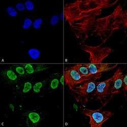 Invitrogen CaV3.1 Monoclonal Antibody (N178A/9), APC 100 &mu;g; APC:Antibodies,