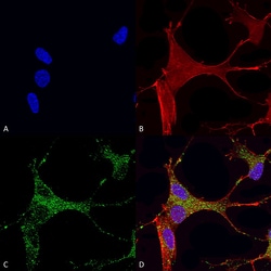 Invitrogen CaV3.1 Monoclonal Antibody (N178A/9), PerCP 100 &mu;g; PerCP:Antibodies,