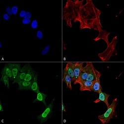 Invitrogen mGluR1/mGluR5 Monoclonal Antibody (N75/33), PE 100 &mu;g; PE:Antibodies,