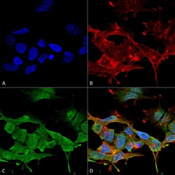 Invitrogen CLCN3 Monoclonal Antibody (N258/5), PerCP 100 &mu;g; PerCP:Antibodies,