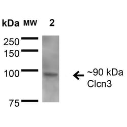 Invitrogen CLCN3 Monoclonal Antibody (N258/5), PE 100 &mu;g; PE:Antibodies,
