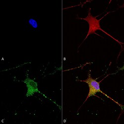 Invitrogen SUR1 Monoclonal Antibody (N289/16), FITC 100 &mu;g; FITC:Antibodies,