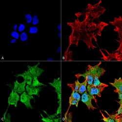 Invitrogen SUR1 Monoclonal Antibody (N289/16), FITC 100 &mu;g; FITC:Antibodies,