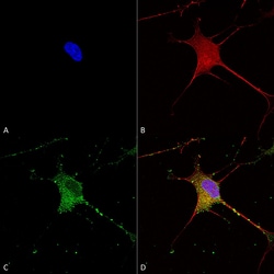 Invitrogen SUR1 Monoclonal Antibody (N289/16), PerCP 100 &mu;g; PerCP:Antibodies,