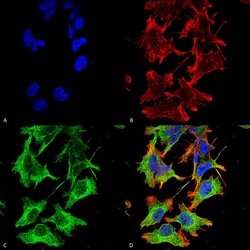 Invitrogen NMDAR1 Monoclonal Antibody (N308/48), PerCP 100 &mu;g; PerCP:Antibodies,