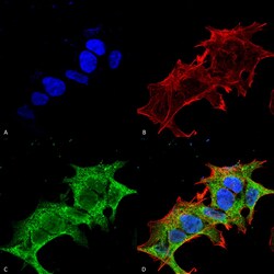 Invitrogen GIT1 Monoclonal Antibody (N39B/8), FITC 100 &mu;g; FITC:Antibodies,