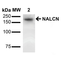 Invitrogen NALCN Monoclonal Antibody (N187/7), APC 100 &mu;g; APC:Antibodies,