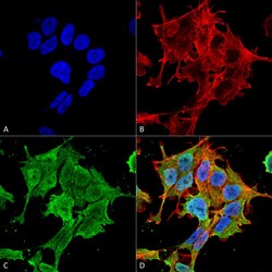 Invitrogen ASIC1 Monoclonal Antibody (N271/44), PE 100 &mu;g; PE:Antibodies,