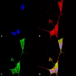 Invitrogen Brevican Monoclonal Antibody (N294A/6), PerCP 100 &mu;g; PerCP:Antibodies,
