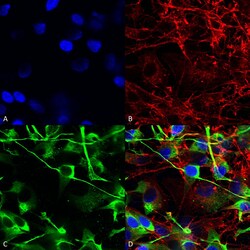 Invitrogen NMDAR2A Monoclonal Antibody (N327/95), PE 100 &mu;g; PE:Antibodies,