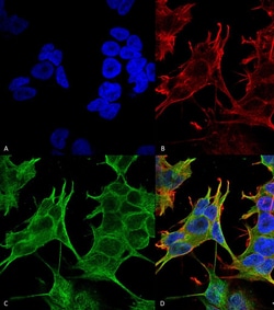 Invitrogen NMDAR2A Monoclonal Antibody (N327/95), PE 100 &mu;g; PE:Antibodies,