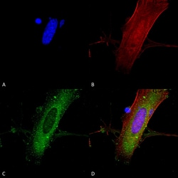 Invitrogen NMDAR2A Monoclonal Antibody (N327A/38), FITC 100 &mu;g; FITC:Antibodies,