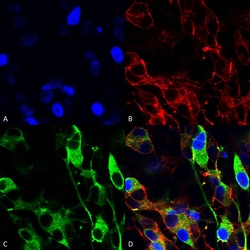 Invitrogen Versican Monoclonal Antibody (N351/23), FITC 100 &mu;g; FITC:Antibodies,