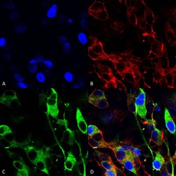 Invitrogen Versican Monoclonal Antibody (N351/23), PE 100 &mu;g | Buy Online | Invitrogen&trade; | Fisher Scientific