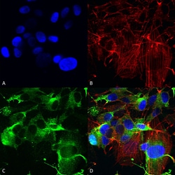 Invitrogen GluR1 Monoclonal Antibody (N355/1), APC 100 &mu;g; APC:Antibodies,