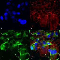 Invitrogen GluR1 Monoclonal Antibody (N355/1), PE 100 &mu;g; PE:Antibodies,