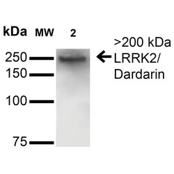 Invitrogen LRRK2 Monoclonal Antibody (N231B/34), APC 100 &mu;g; APC:Antibodies,