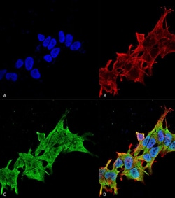 Invitrogen LRRK2 Monoclonal Antibody (N231B/34), FITC 100 &mu;g; FITC:Antibodies,