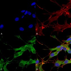 Invitrogen LRRK2 Monoclonal Antibody (N138/6), FITC 100 &mu;g; FITC:Antibodies,