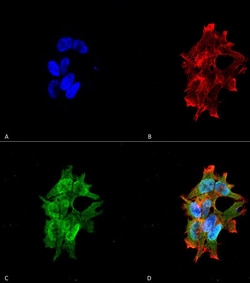 Invitrogen LRRK2 Monoclonal Antibody (N138/6), FITC 100 &mu;g; FITC:Antibodies,