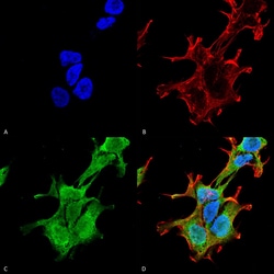Invitrogen PINK1 Monoclonal Antibody (N4/15), PerCP 100 &mu;g; PerCP:Antibodies,