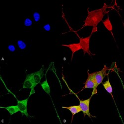 Invitrogen Ataxin 1 Monoclonal Antibody (N76/8), PerCP 100 &mu;g; PerCP:Antibodies,
