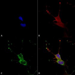 Invitrogen LGI1 Monoclonal Antibody (N283/7), FITC 100 &mu;g; FITC:Antikroppar