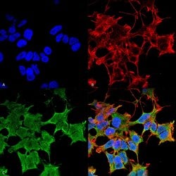 Invitrogen LGI1 Monoclonal Antibody (N283/7), PerCP 100 &mu;g; PerCP:Antibodies,