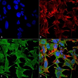 NRCAM Monoclonal Antibody (S364-51), PE, Invitrogen 100 &mu;g; PE:Antibodies,